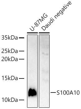 S100A10 Rabbit polyclonal antibody