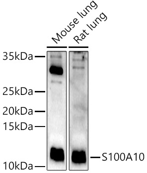 S100A10 Rabbit polyclonal antibody