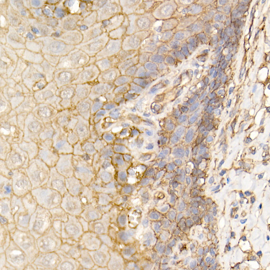 S100A10 Rabbit polyclonal antibody