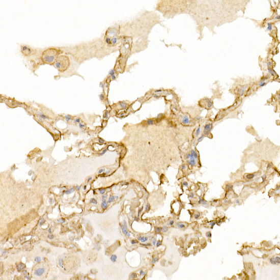 S100A10 Rabbit polyclonal antibody