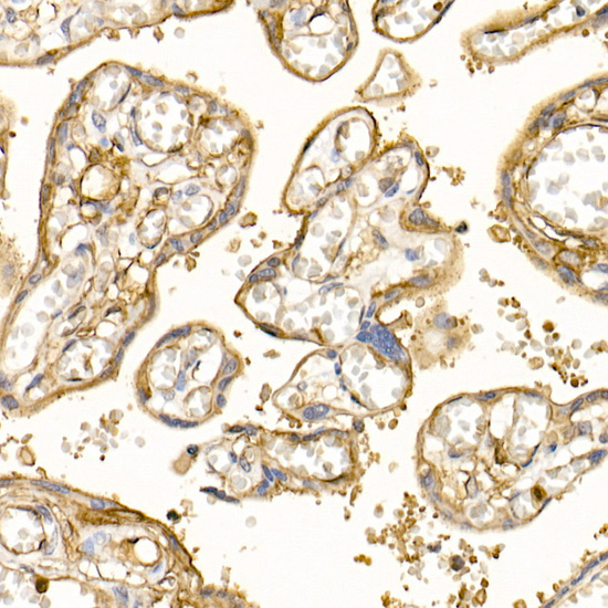 S100A10 Rabbit polyclonal antibody