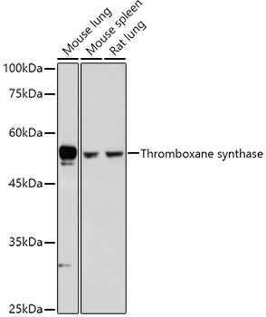Thromboxane synthase Rabbit polyclonal antibody