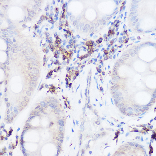 Thromboxane synthase Rabbit polyclonal antibody