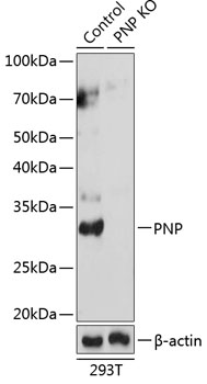 [KO Validated] PNP Rabbit polyclonal antibody