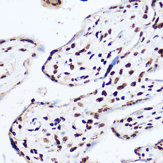 OGT Rabbit polyclonal antibody