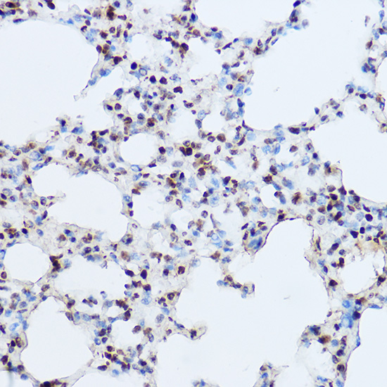 OGT Rabbit polyclonal antibody