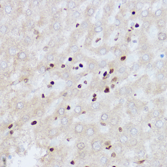 OGT Rabbit polyclonal antibody