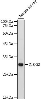 INSIG2 Rabbit polyclonal antibody