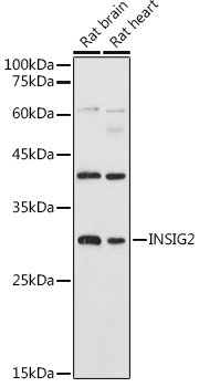 INSIG2 Rabbit polyclonal antibody