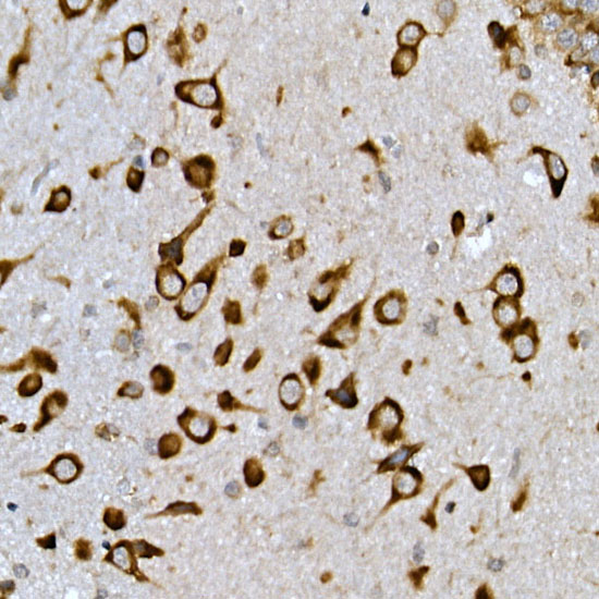 INSIG2 Rabbit polyclonal antibody
