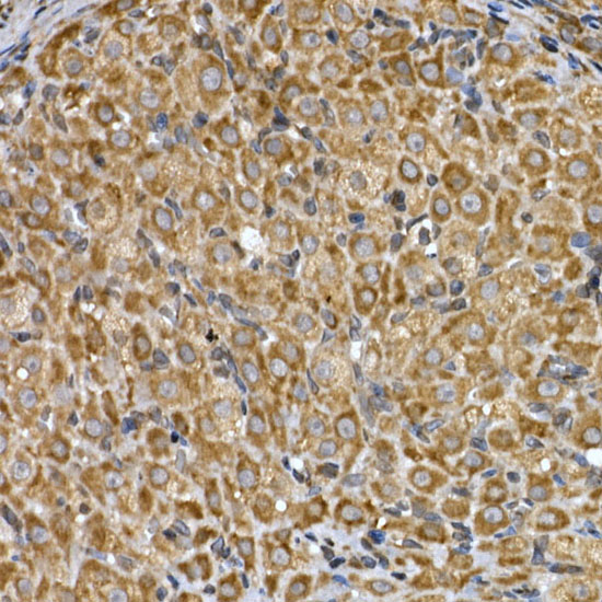 INSIG2 Rabbit polyclonal antibody