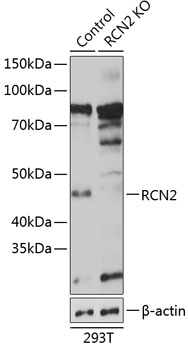 [KO Validated] RCN2 Rabbit polyclonal antibody