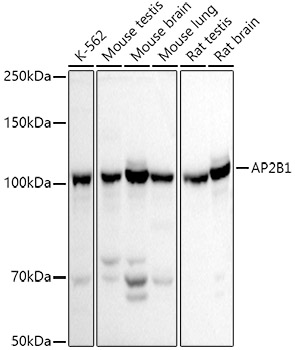 AP2B1 Rabbit polyclonal antibody