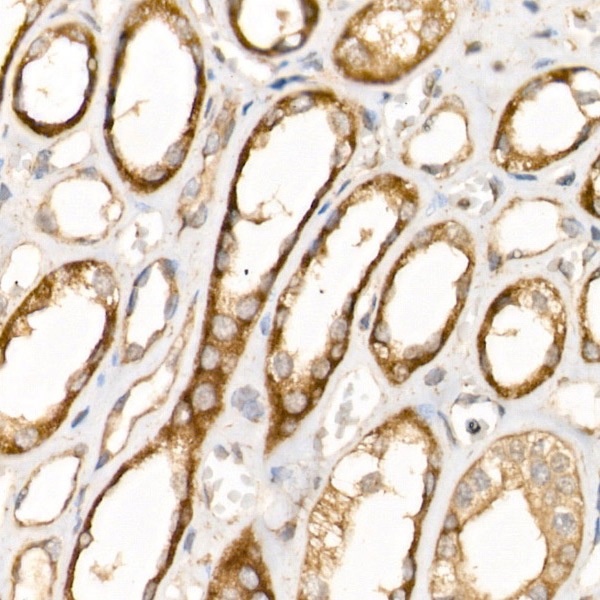 AP2B1 Rabbit polyclonal antibody