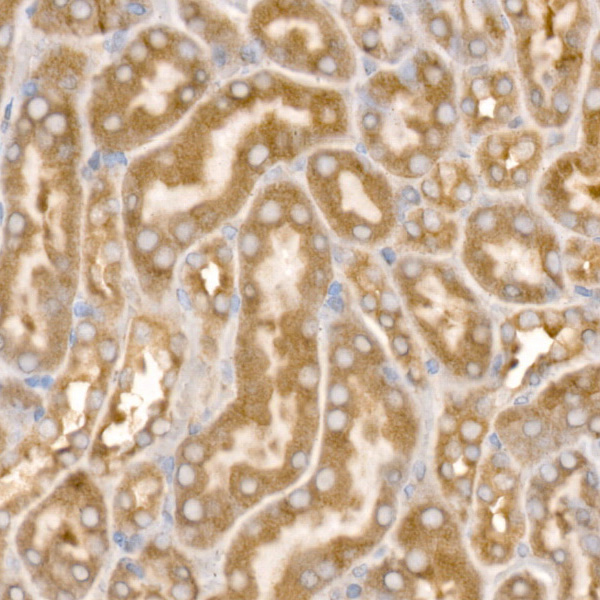 AP2B1 Rabbit polyclonal antibody