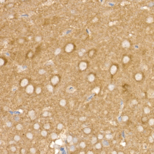 AP2B1 Rabbit polyclonal antibody
