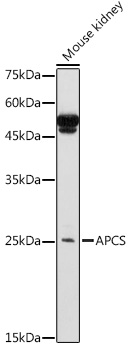 APCS Rabbit polyclonal antibody