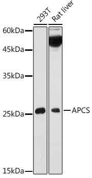 APCS Rabbit polyclonal antibody