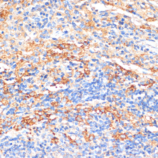 APCS Rabbit polyclonal antibody