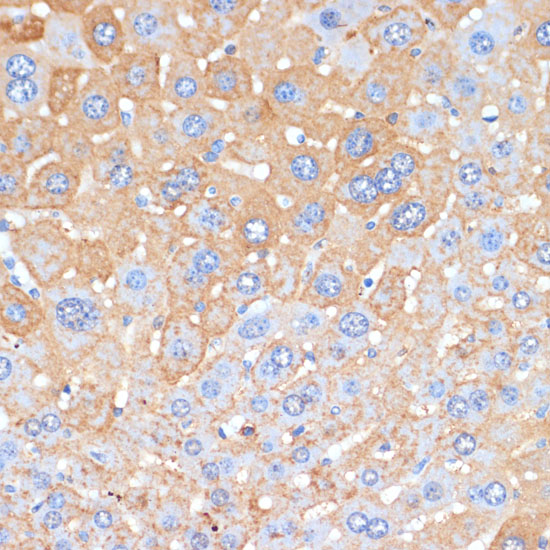 APCS Rabbit polyclonal antibody