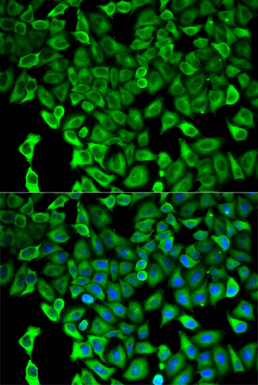 PSMD2 Rabbit polyclonal antibody