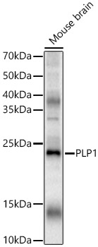 PLP1 Rabbit polyclonal antibody