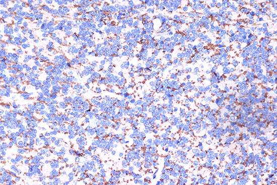 PLP1 Rabbit polyclonal antibody