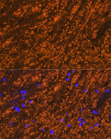 PLP1 Rabbit polyclonal antibody