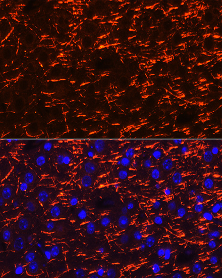 PLP1 Rabbit polyclonal antibody