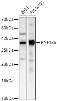 RNF126 Rabbit polyclonal antibody