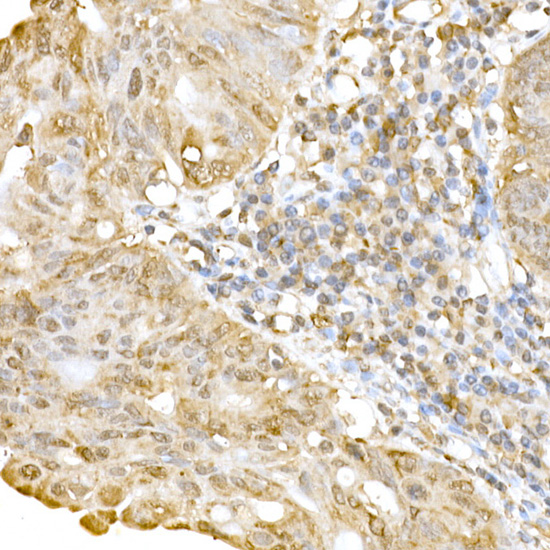 RNF126 Rabbit polyclonal antibody