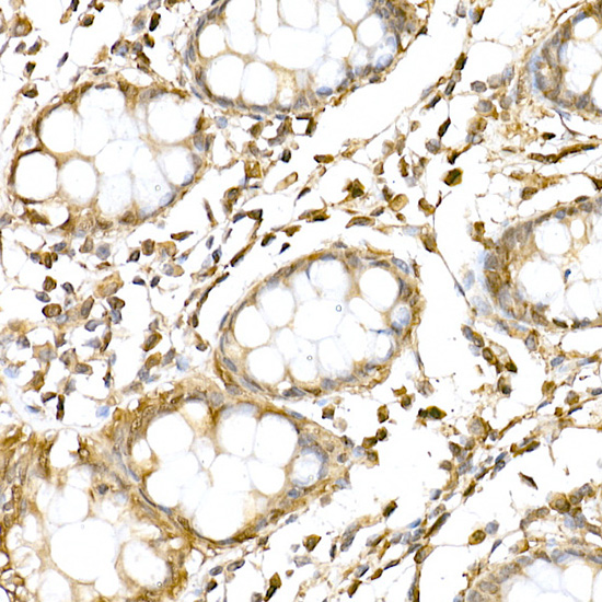 RNF126 Rabbit polyclonal antibody