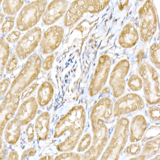 RNF126 Rabbit polyclonal antibody