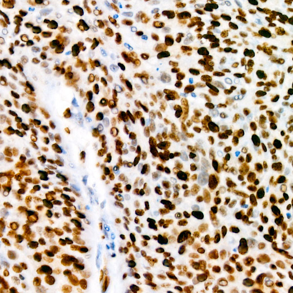 [KO Validated] Ki67 Rabbit monoclonal antibody