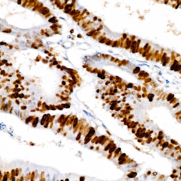 [KO Validated] Ki67 Rabbit monoclonal antibody