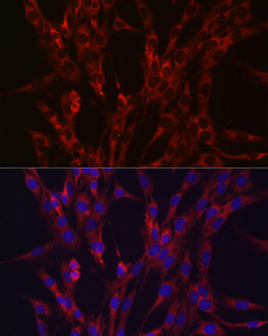 HIF3A Rabbit polyclonal antibody