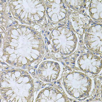PTP4A3 Rabbit polyclonal antibody