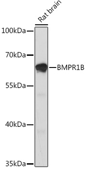 Western blot analysis of lysates from Rat brain, using BMPR1B Rabbit pAb (A2005) at 1:1000 dilution.<br/>Secondary antibody: HRP-conjugated Goat anti-Rabbit IgG (H+L) (AS014) at 1:10000 dilution.<br/>Lysates/proteins: 25μg per lane.<br/>Blocking buffer: 3% nonfat dry milk in TBST.<br/>Detection: ECL Enhanced Kit (RM00021).<br/>Exposure time: 3min.