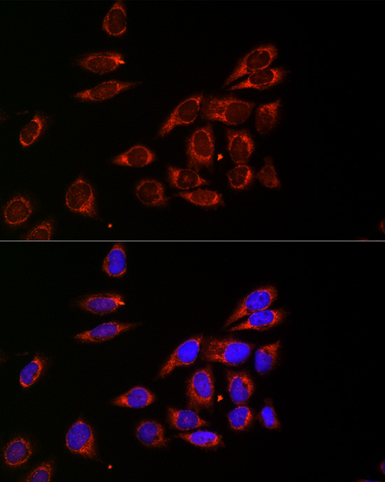CDA Rabbit polyclonal antibody