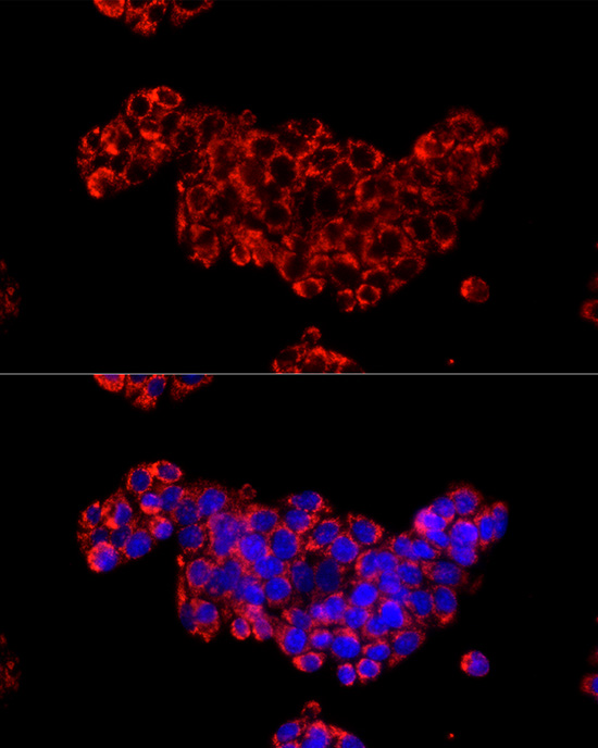 CDA Rabbit polyclonal antibody