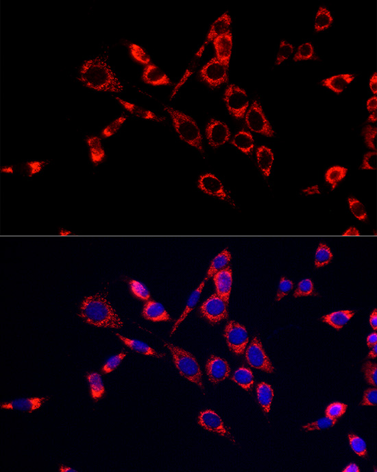 CDA Rabbit polyclonal antibody