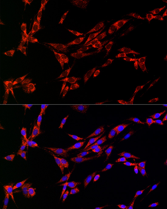 CDA Rabbit polyclonal antibody