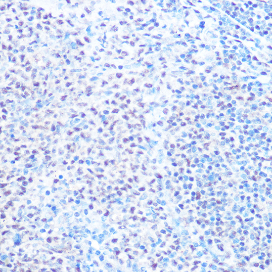 SNRPB Rabbit polyclonal antibody