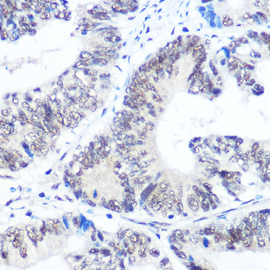 SNRPB Rabbit polyclonal antibody