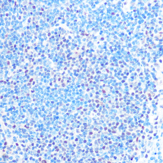 SNRPB Rabbit polyclonal antibody