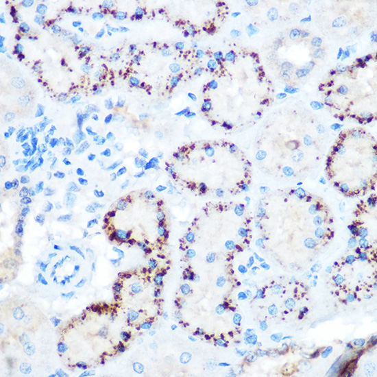ANGPTL4 Rabbit polyclonal antibody