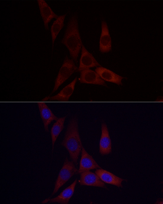 ANGPTL4 Rabbit polyclonal antibody