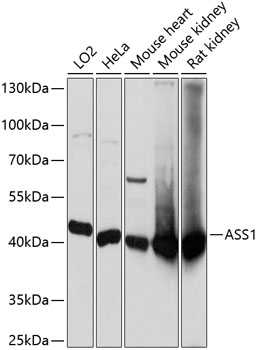 ASS1 Rabbit polyclonal antibody