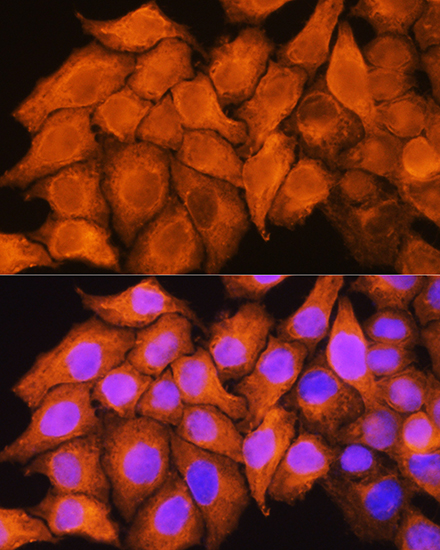 ASS1 Rabbit polyclonal antibody