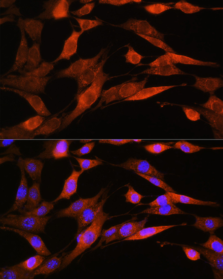 ASS1 Rabbit polyclonal antibody